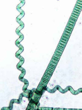 Une bactrie  serpentine : la spirulline